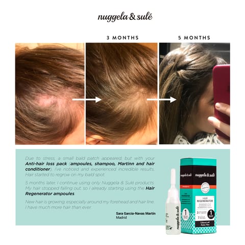 Neo Hair Lotion 120 ML