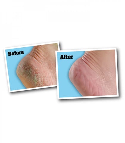 Baby Foot Shea Butter Moisture Cream 80 Gm