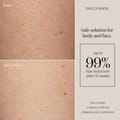 SmoothSkin Pure Fit IPL Hair Removal Device with Laser